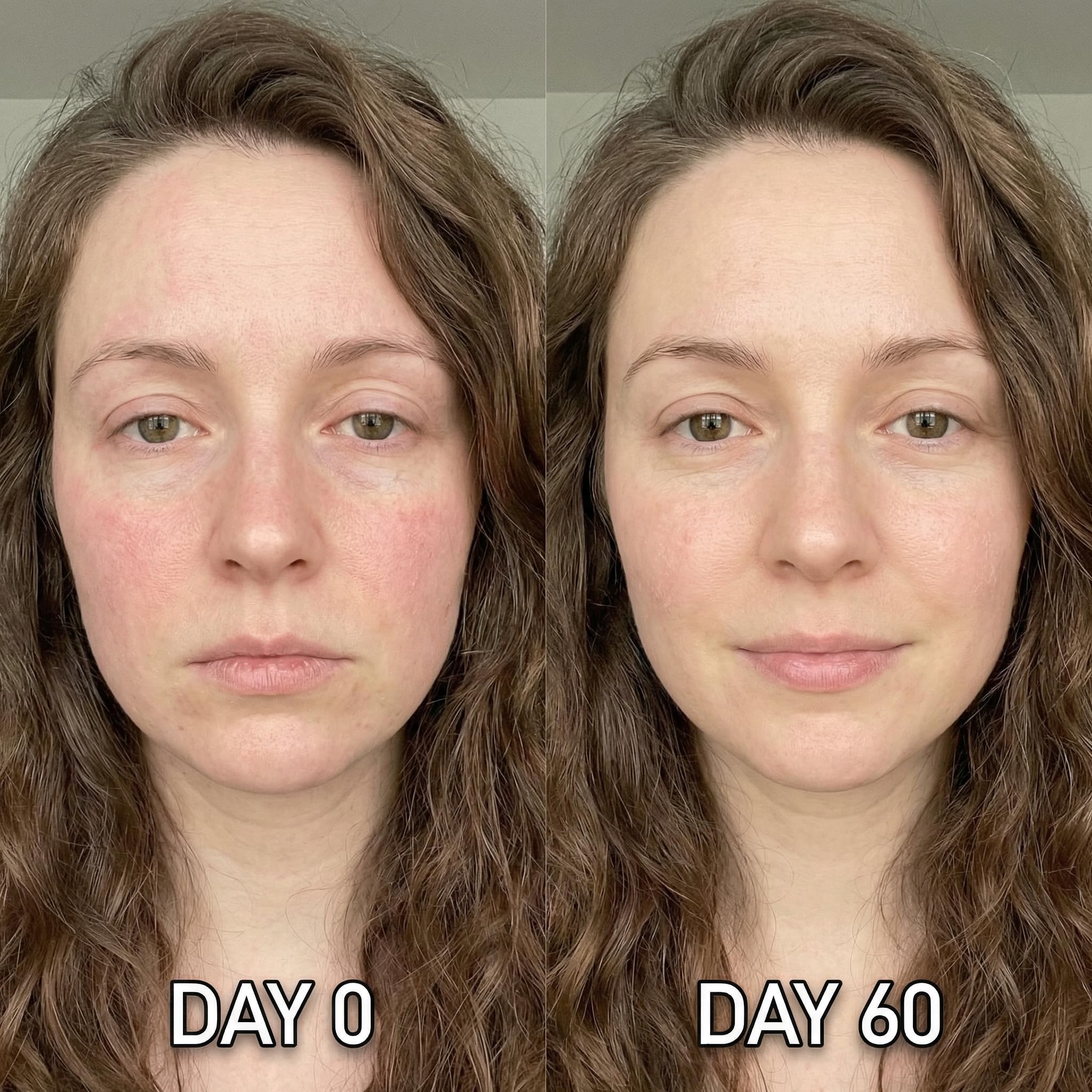 Face Micro Infusion system z At domowy Anti-aging zestaw