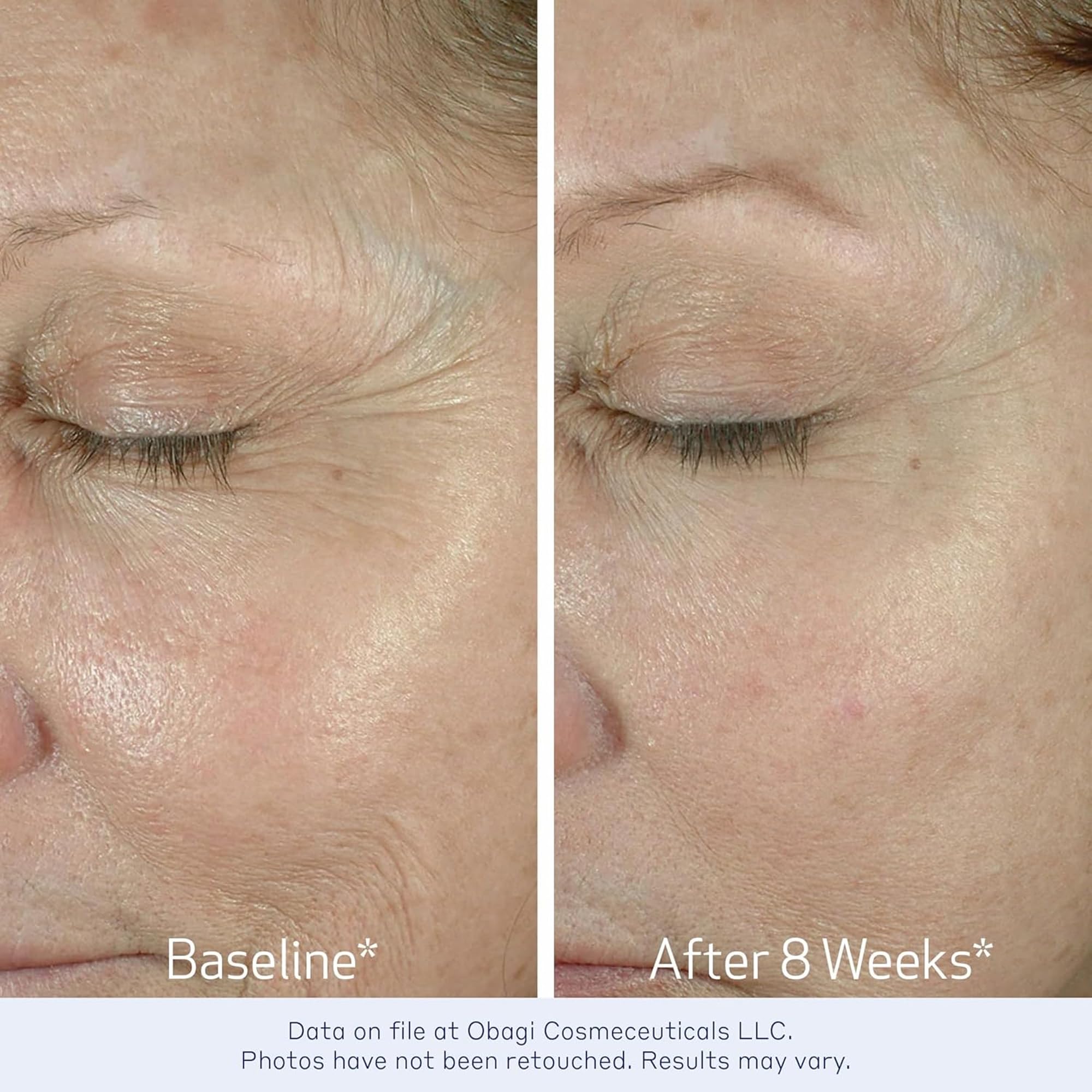 Elastiderm Eye kremowy, lekki Anti-aging Formula