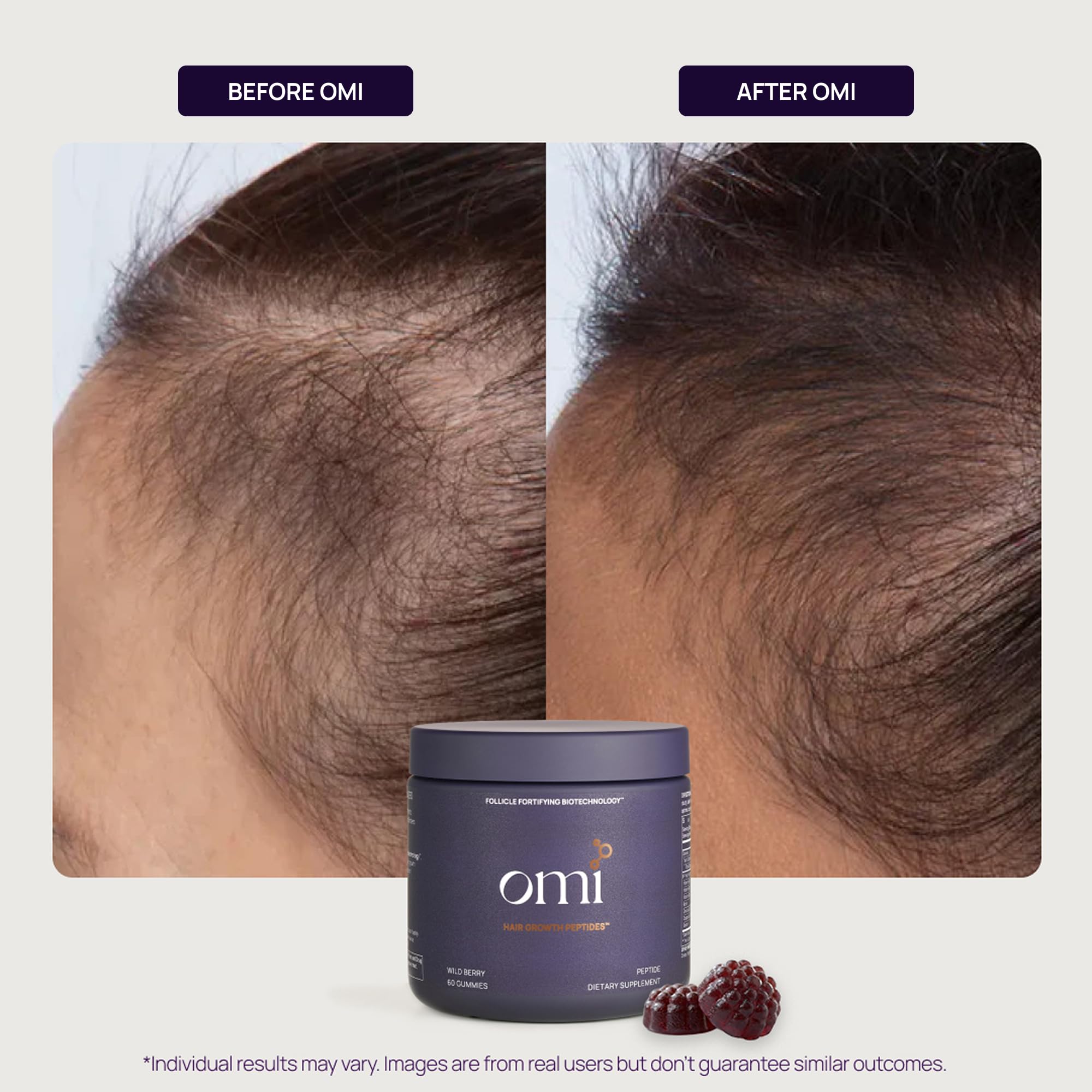 1787597764_QMyS314f Wellbeauty Omi włosów Growth Peptides Gummies do Women z Wild Berry