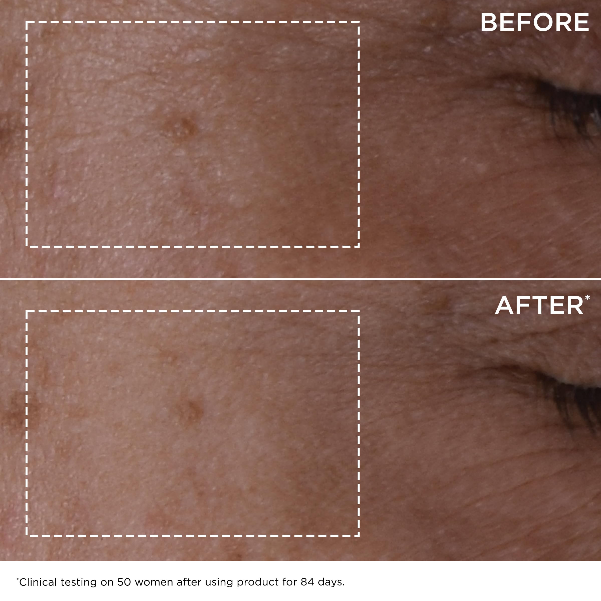Podwójny Serum, Anti-aging Face Serum do Radiance